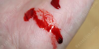 bloed bij de hand films