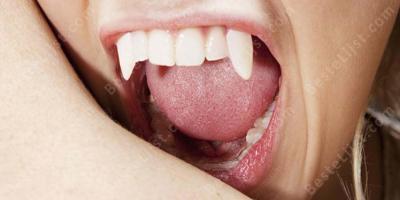 in de nek gebeten films