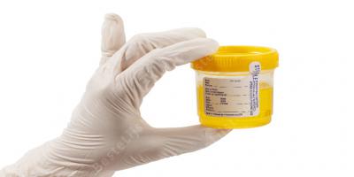 urine films