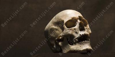 schedel verpletteren films