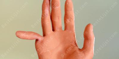 gebroken vinger films