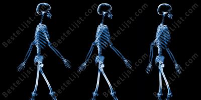 geröntgend skelet films