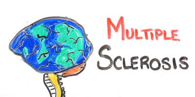 multiple sclerose films