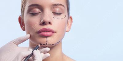 plastische chirurgie films