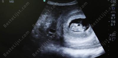 echografie films