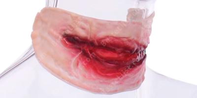 valse verwonding films