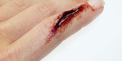 vinger gesneden films